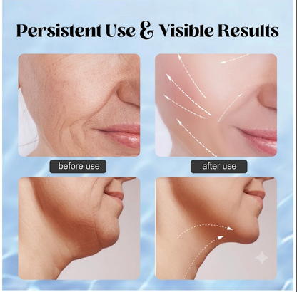 Intense Pulsed Light Wrinkles Reducing Instrument